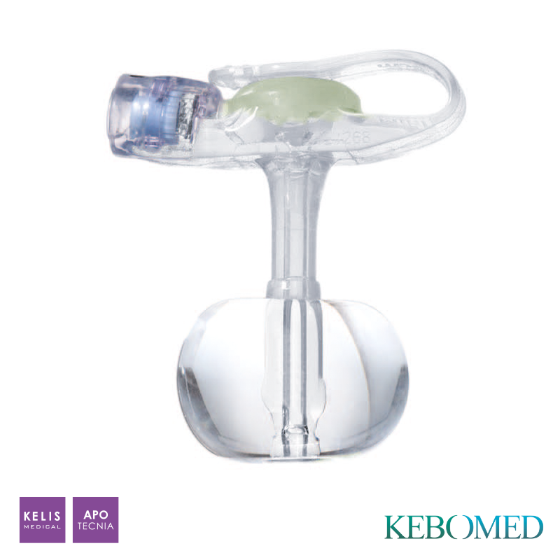 Boutons de gastrostomie - Avec ballonnet - Minione Balloon | KEBOMED